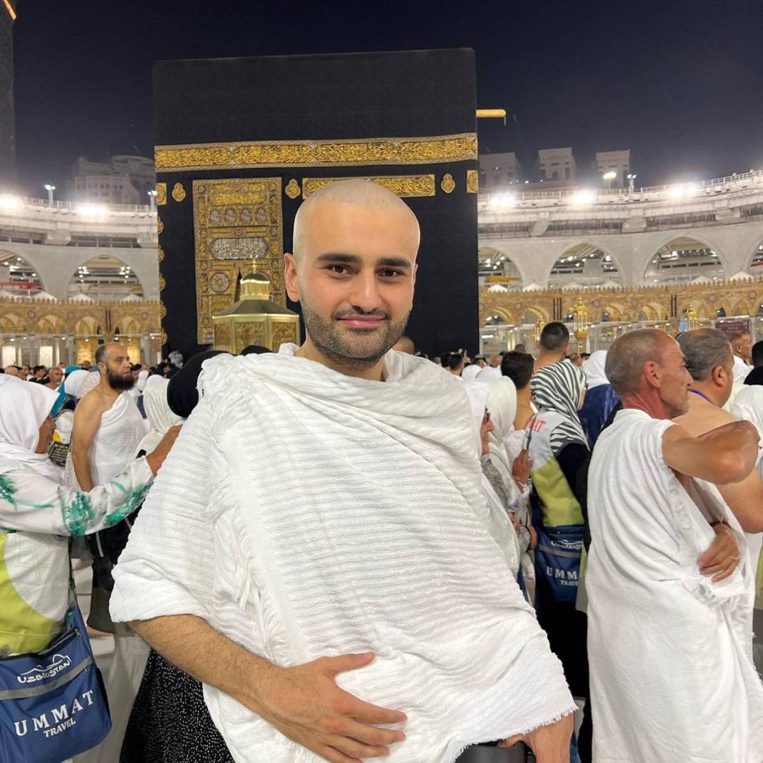 CZN Burak kanser mi? Aşırı zayıflaması korkutmuştu, şimdi de saçlarını kazıttı! 9